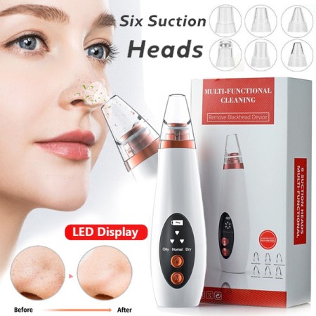 Multifunctional Blackheads Remover